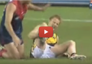 There have been a lot of broken legs in sport, but this one is as nasty as it gets