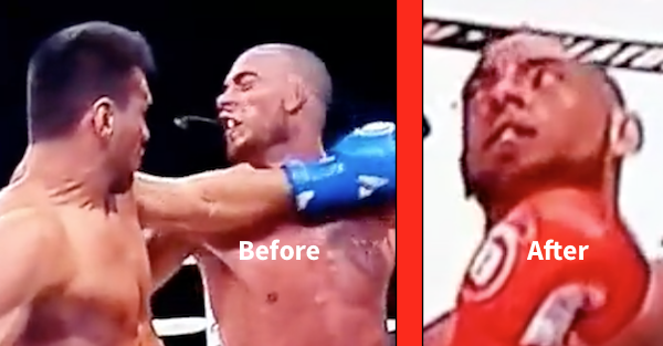 Kickboxer knocked his opponent, and his tooth, out with brutal spinning backhand