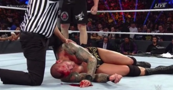 LOOK: Randy Orton bled on the mat and needed 10 staples to close this huge, nasty gash on his head