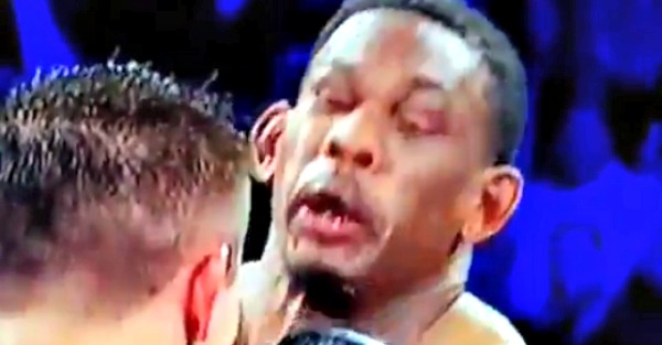 This boxer got hit in the face so hard it looked like his ears were ...