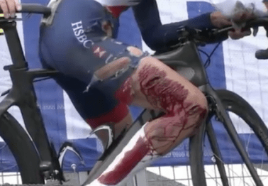 Cyclist toughs out World Championship race after crash causes horrendous gash